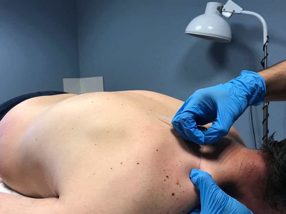 Todo lo que debes saber sobre clínica de fisioterapia Anxo R.V.